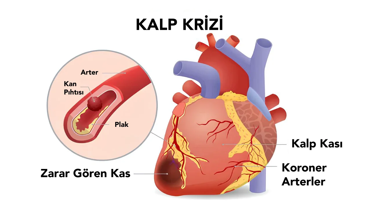 Cem Yılmaz'ın Kulak Çizgisi Tartışması: Kalp Krizi Belirtisi mi?