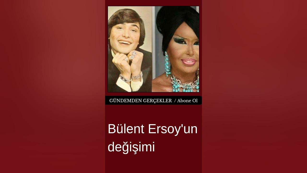 Lolita Lift Sonrası Bülent Ersoy: "Bana Artık Abla Demeyin" Çıkışı