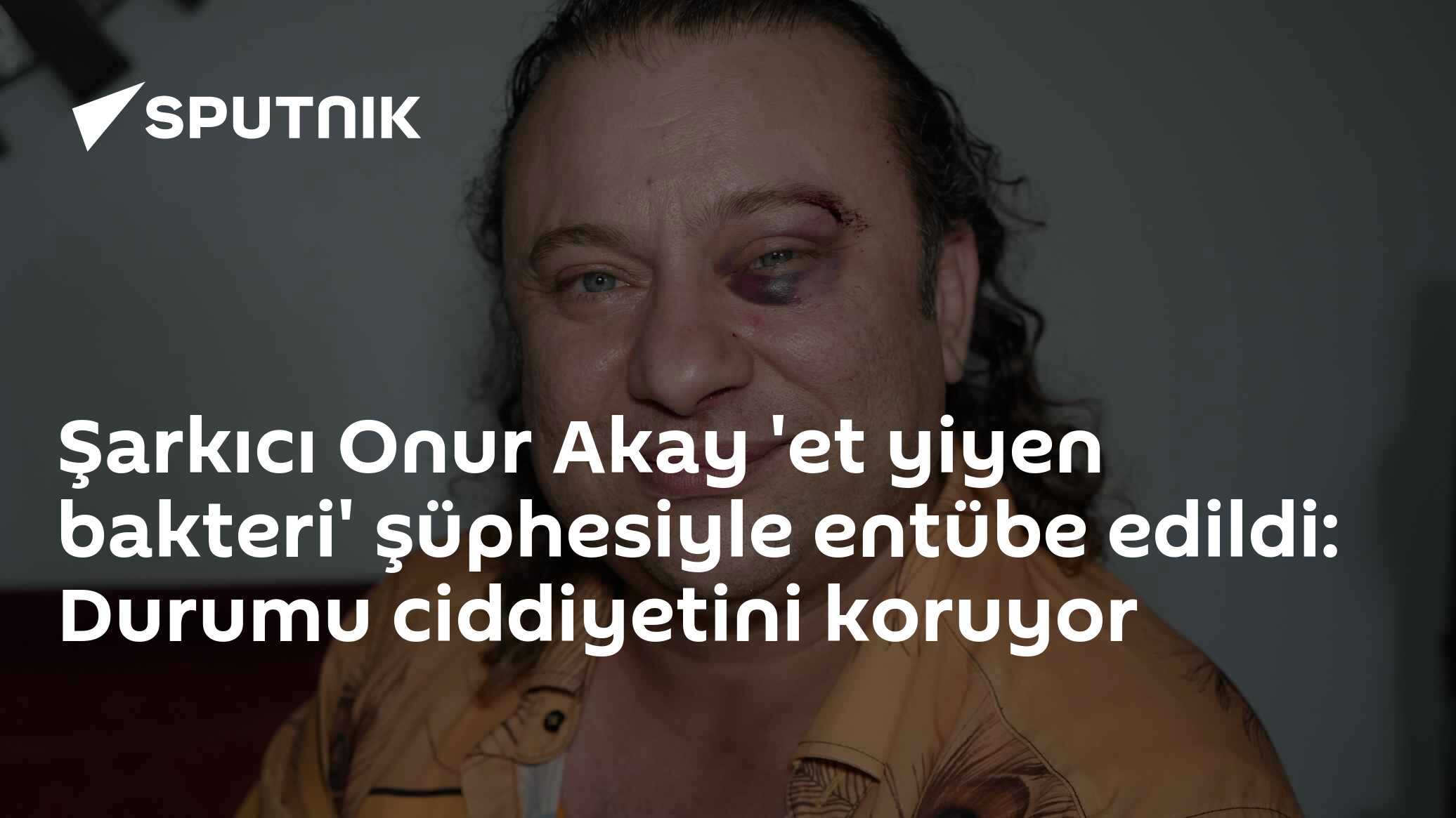 Şarkıcı Nev'den Üzücü Haber: Yeniden Entübe Edildi, Durumu Kritik