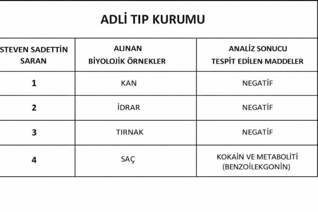 Uyuşturucu Testi Pozitif Çıktı: Afra Saraçoğlu'ndan Dikkat Çeken Savunma